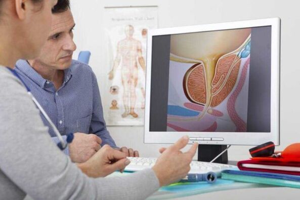 de arts raadpleegt de patiënt over de kwestie van prostatitis